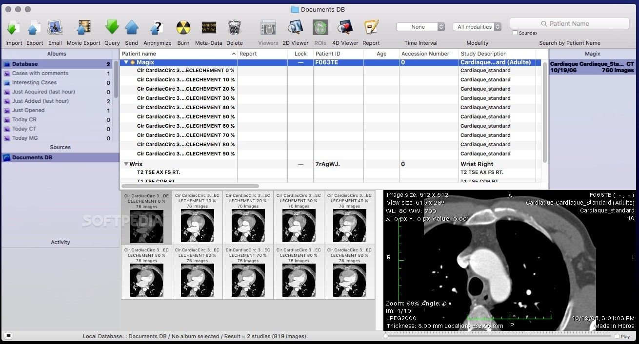 dcm viewer free for mac